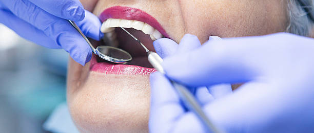 Best Dentist for Tooth Abscess  in Lanark, IL